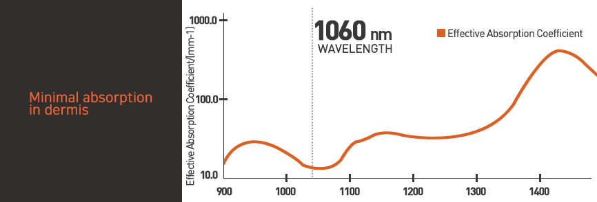 Slimus LVAT (Laser Vibration Alliance Technology) Technology