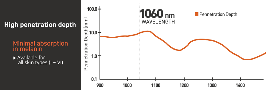 Slimus LVAT (Laser Vibration Alliance Technology) Technology